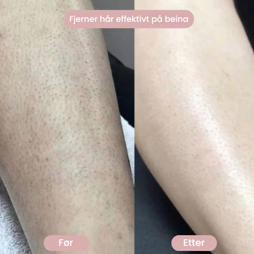 SilkySkin â Intimbarbering uten irritasjon